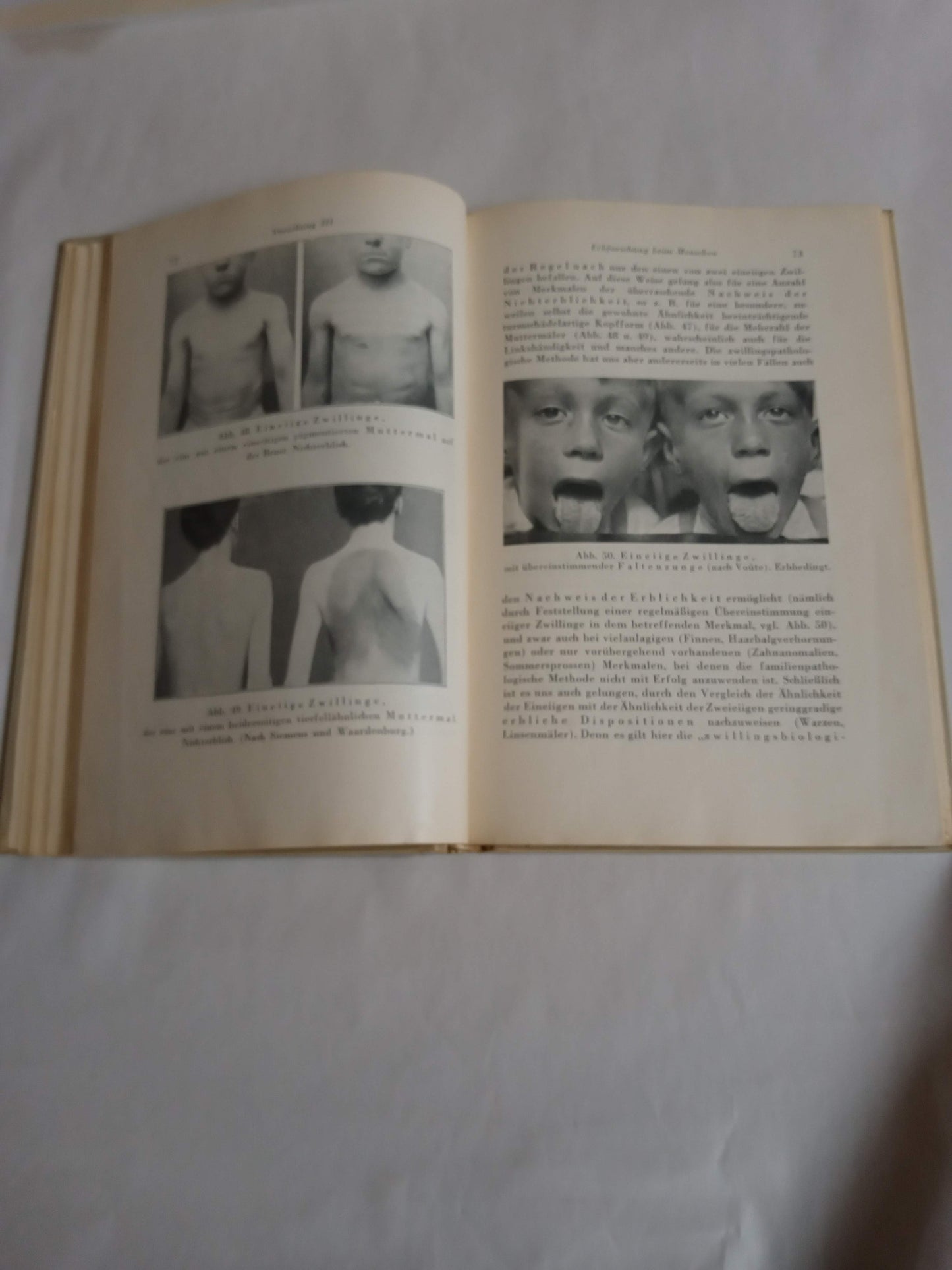 Grundzüge Der Vererbungslehre, Rassenhygiene Und Bevölkerungspolitik